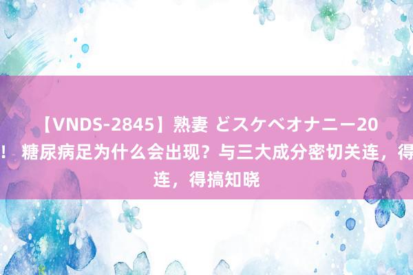 【VNDS-2845】熟妻 どスケベオナニー20連発！！ 糖尿病足为什么会出现？与三大成分密切关连，得搞知晓